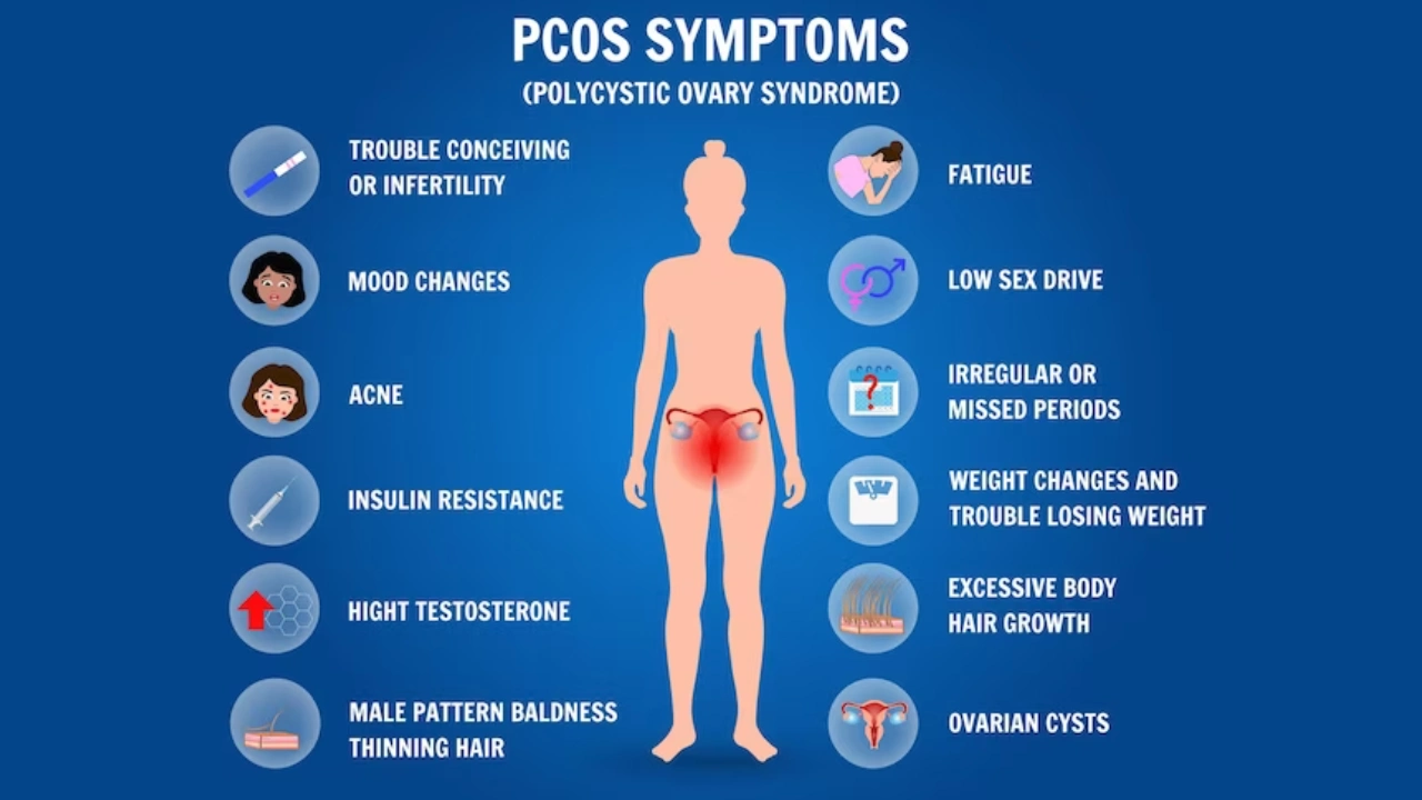 Symptoms of PCOS