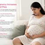 Find pregnancy piles treatment and expert care support for hemorrhoid relief in Pune